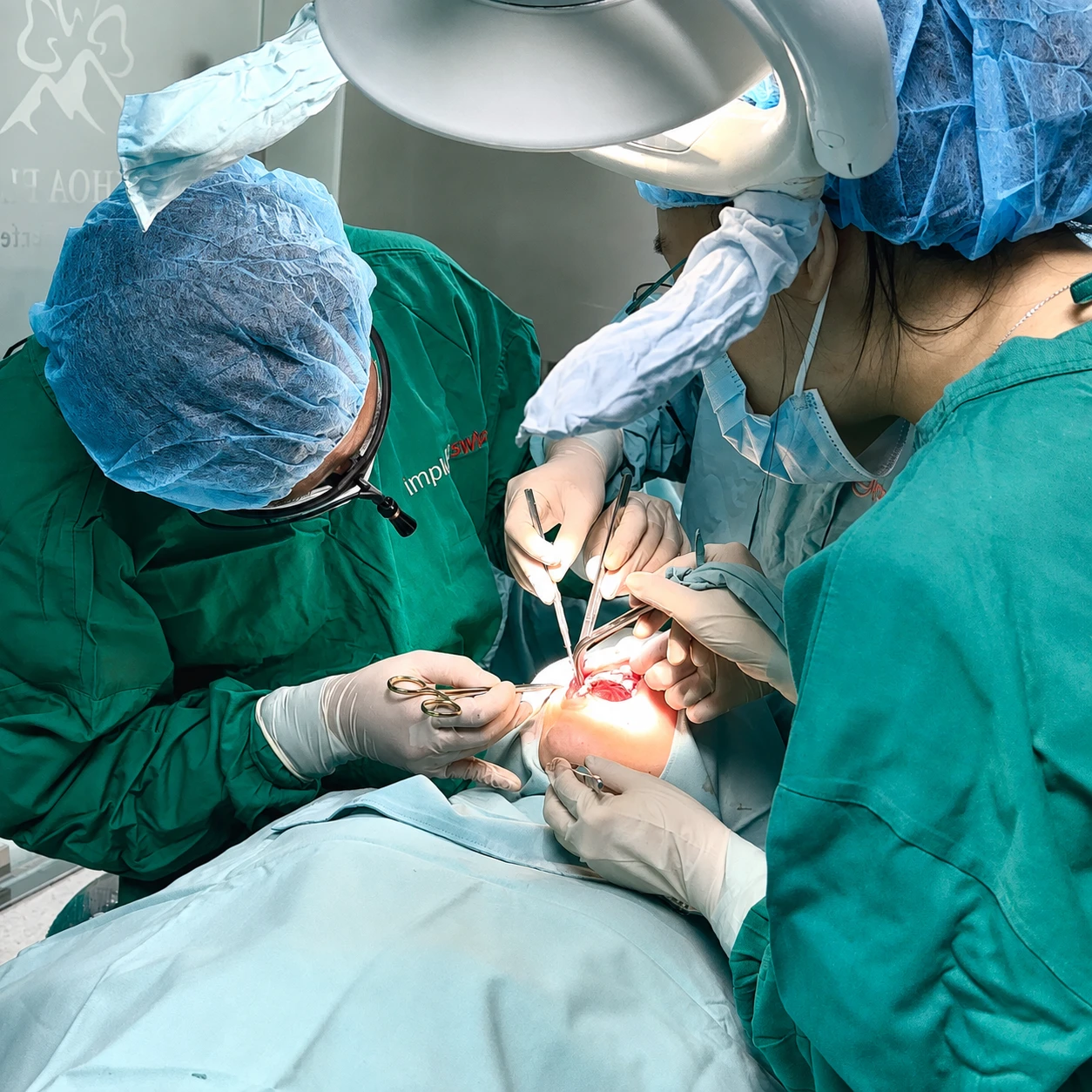 Khách hàng điều trị cười hở lợi 3