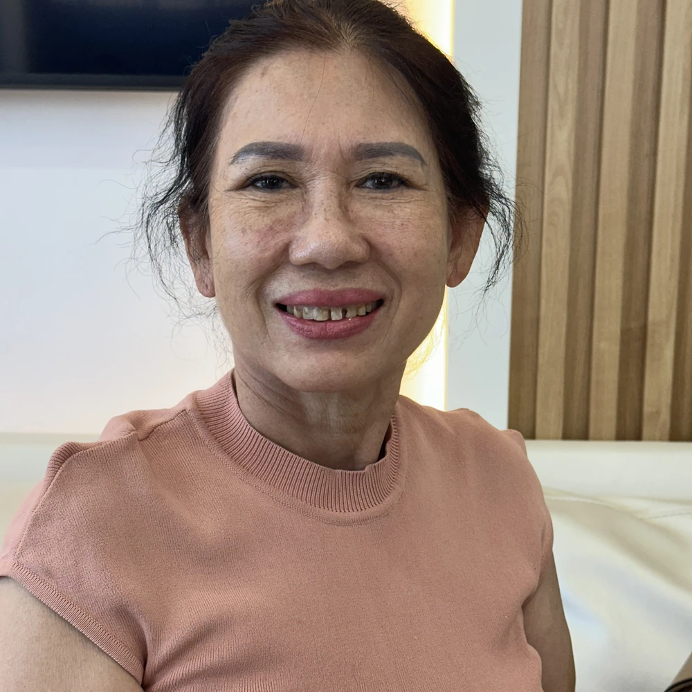 Cô Nguyễn Thị Liên Trước Khi Bọc Răng Sứ