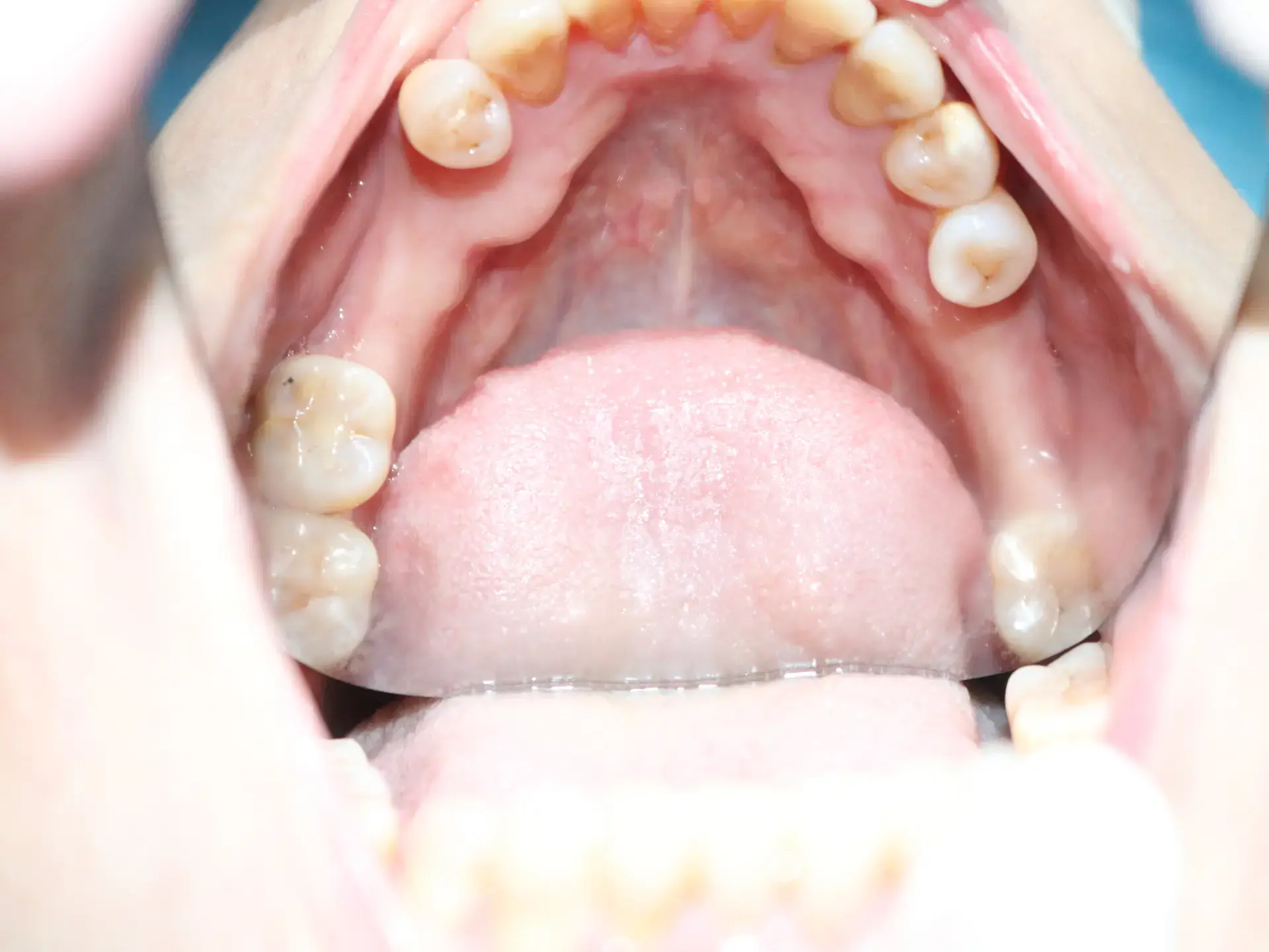 Chị Diễm Châu Trước