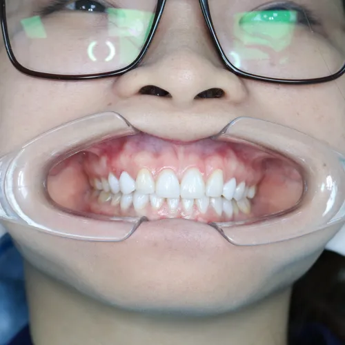 Chị Khánh Trinh Sau