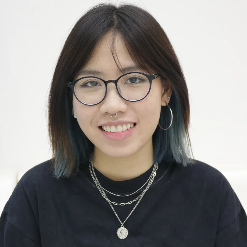 Bạn Huỳnh Cao Thảo My Sau Khi Dán Sứ Veneer