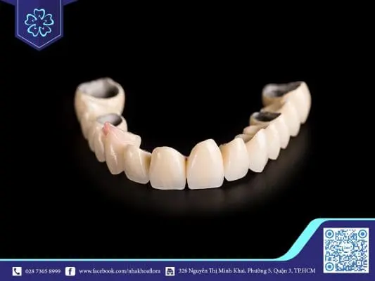 5 lý do bạn nên bọc răng sứ 2