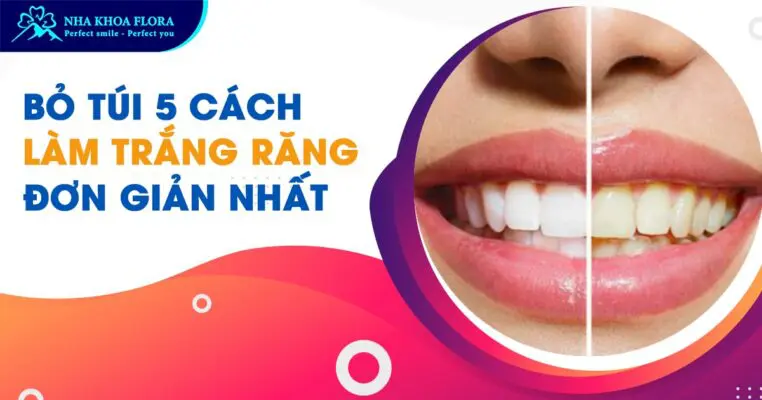 Bỏ túi 5 cách làm trắng răng đơn giản, dễ làm nhất! 2