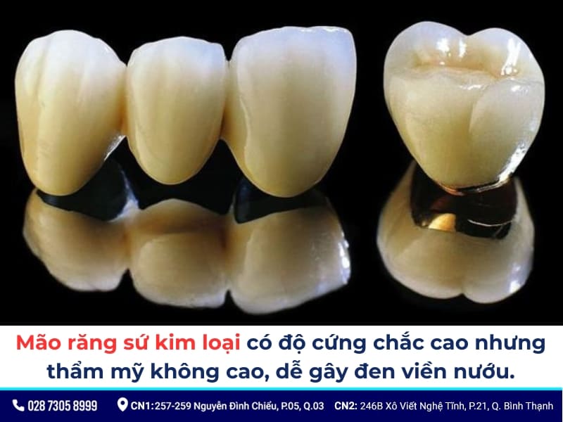 mão răng sứ
