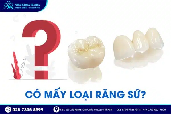 Nên bọc răng sứ loại nào? - Ảnh 1 Nên bọc răng sứ loại nào? - Ảnh 1