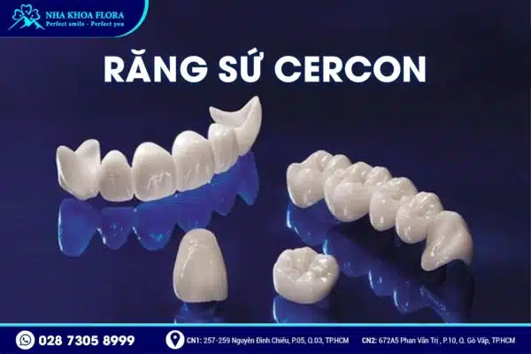 Nên bọc răng sứ loại nào? - Ảnh 4 Nên bọc răng sứ loại nào? - Ảnh 4