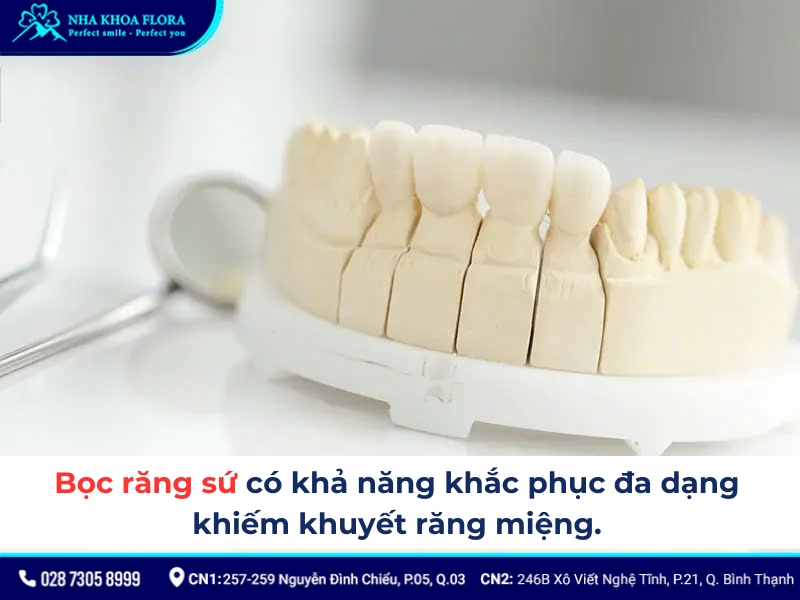 quy trình bọc răng sứ