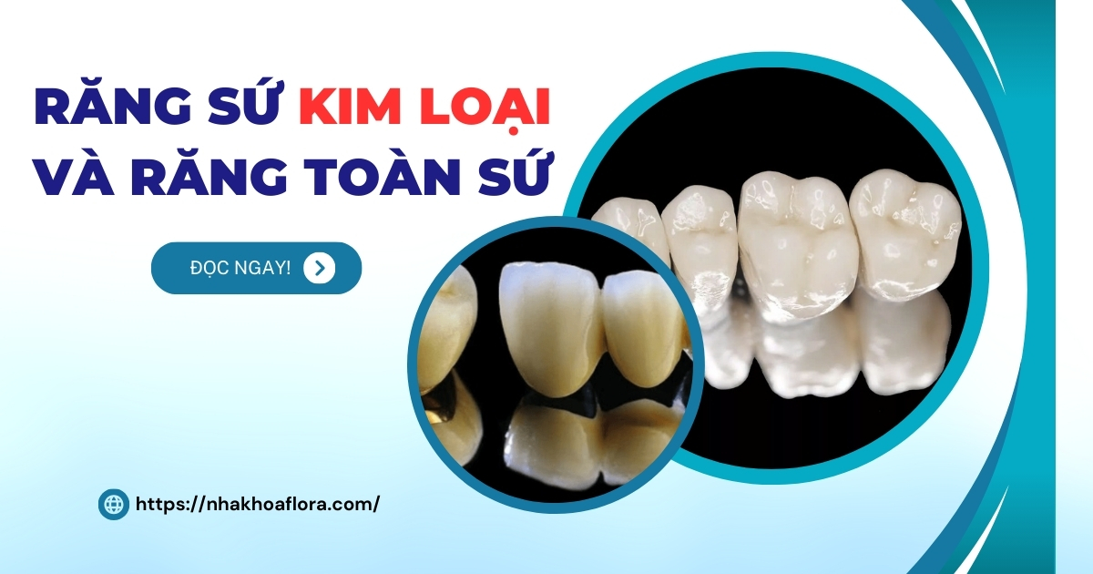 So sánh răng sứ kim loại và răng toàn sứ cái nào tốt hơn?