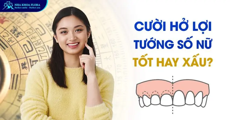 Phụ Nữ Cười Hở Lợi Tướng Số Là Tốt Hay Xấu? 5