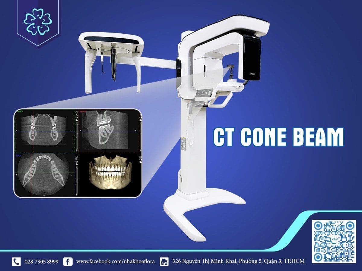 High-tech dental implants with CT Cone Beam machine at Flora Dentistry