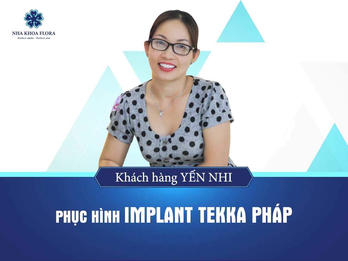 khach-hang-cay-ghep-implant-tai-nha-khoa-implant Khách hàng cấy ghép implant - bác sĩ Nguyễn Đắc Minh phụ trách theo công nghệ 3D Sophis độc quyền