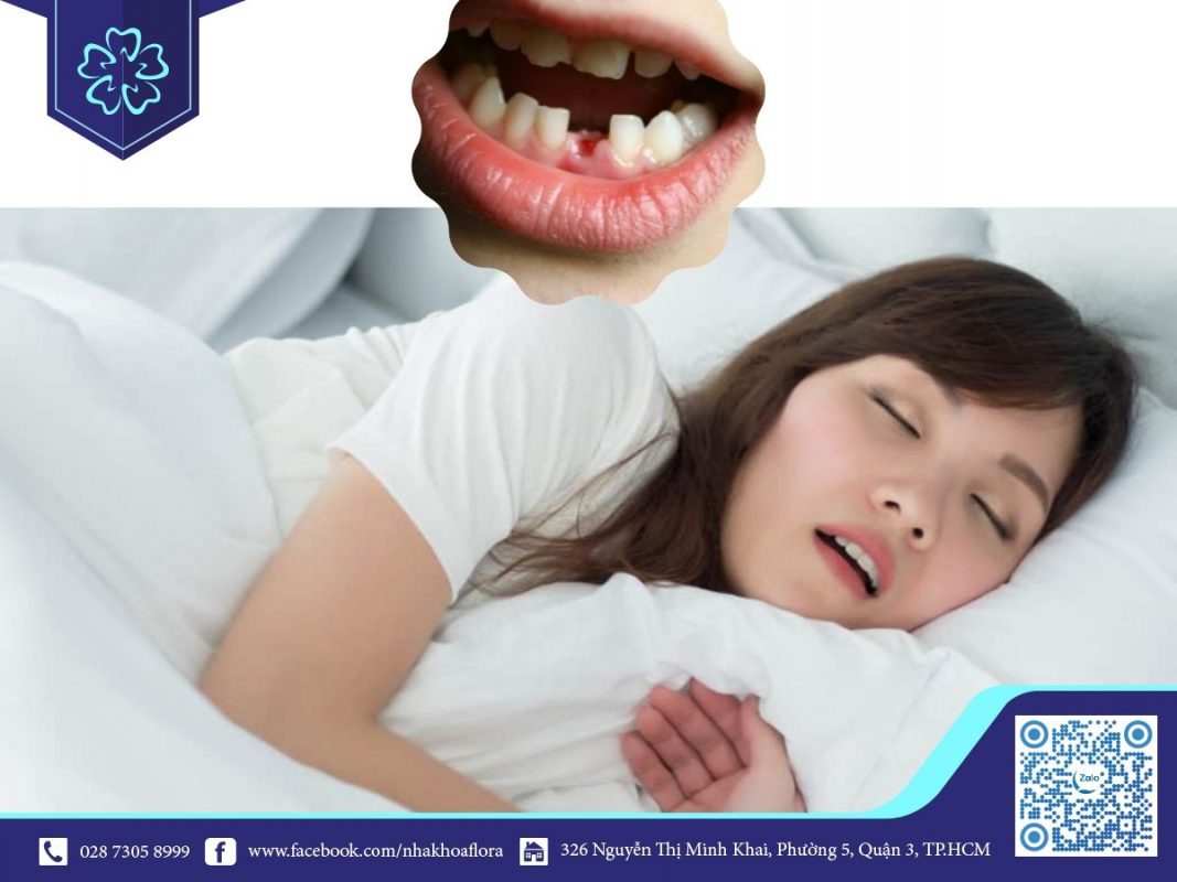 Nằm mơ thấy rụng răng không chảy máu là điềm báo gì? Nằm mơ thấy rụng răng không chảy máu là điềm báo gì?