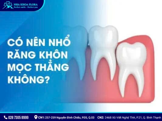 có nên nhổ răng khôn - ảnh 3 có nên nhổ răng khôn - ảnh 3