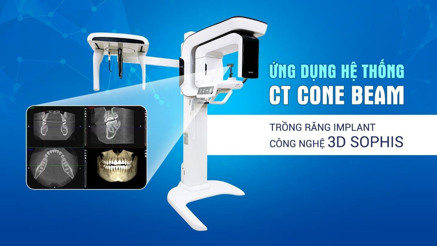CT cone beam trong ứng dụng 3D sophis Thiết bị CT cone beam