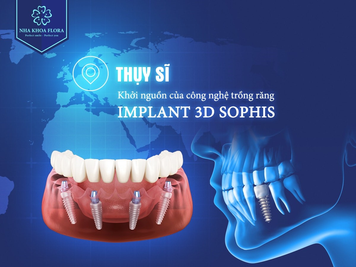 Công nghệ trồng răng implant 3D Sophis Công nghệ 3D Sophis tại nha khoa Flora