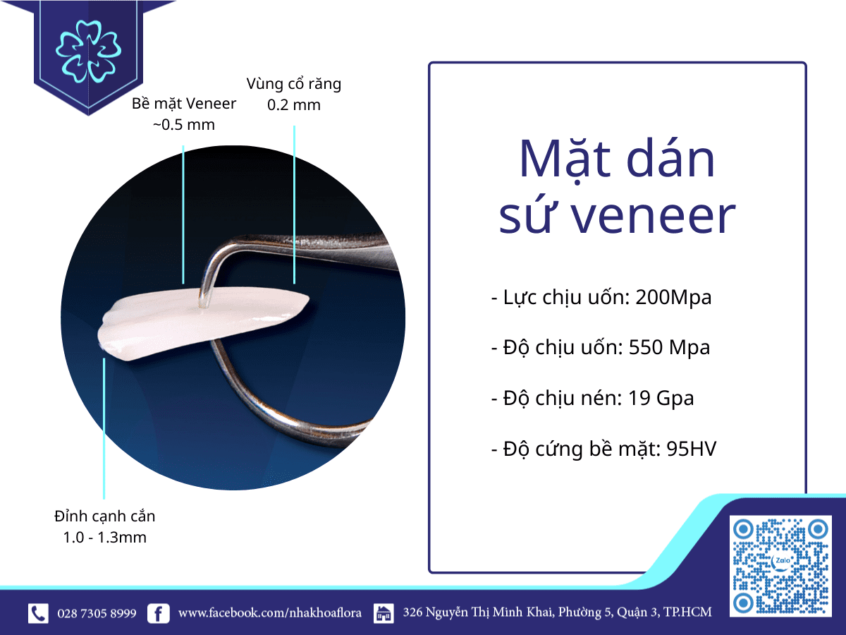 Dán sứ Veneer mỏng nhẹ dán sứ Veneer thẩm mỹ