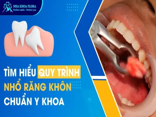 Quy trình nhổ răng khôn chuẩn Y khoa diễn ra như thế nào? 7