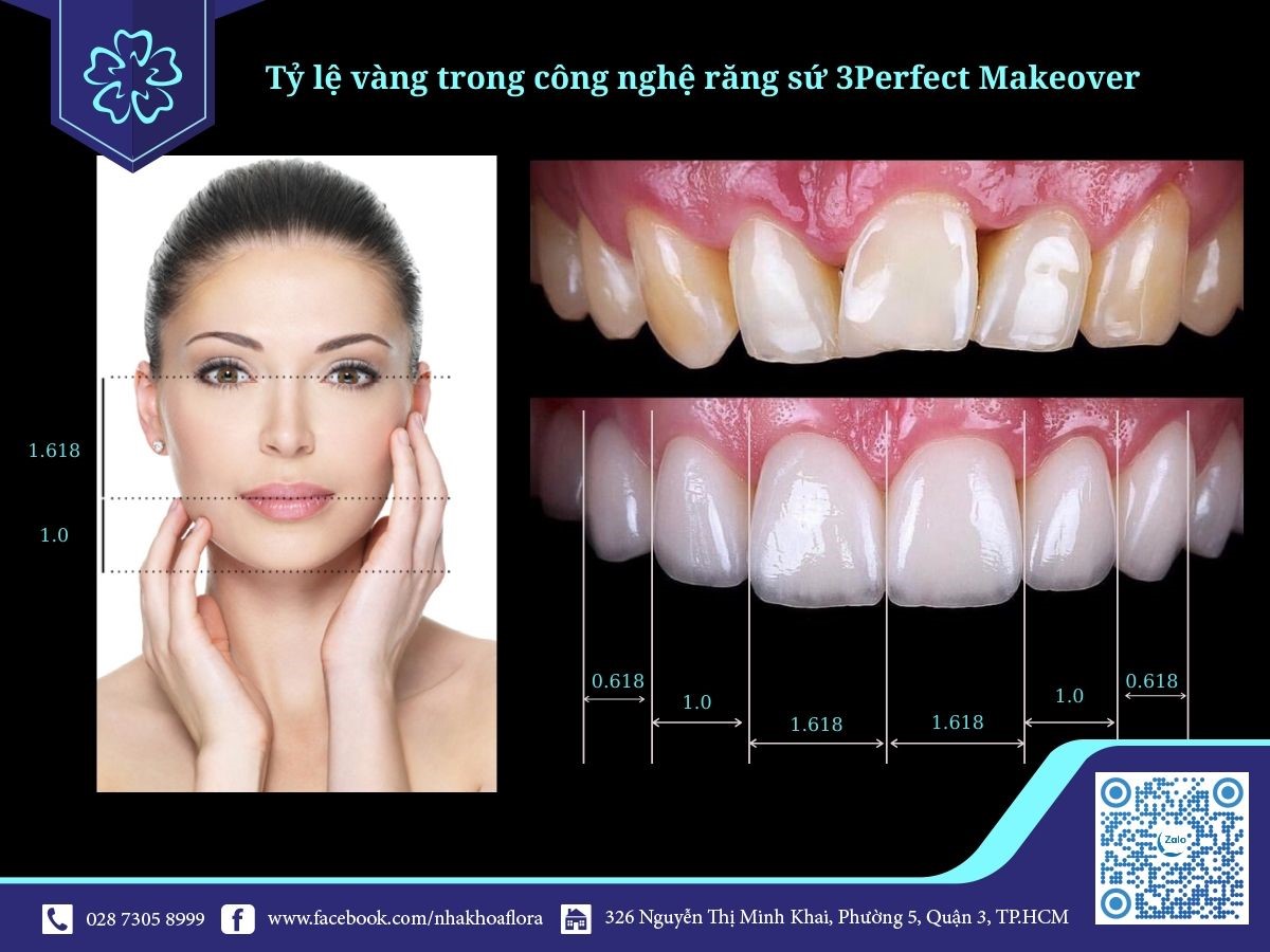 tỷ lệ vàng trong công nghệ bọc răng sứ 3Perfect Makeover Ứng dụng tỷ lệ vàng trong công nghệ bọc răng sứ 3Perfect Makeover tại Nha Khoa Flora