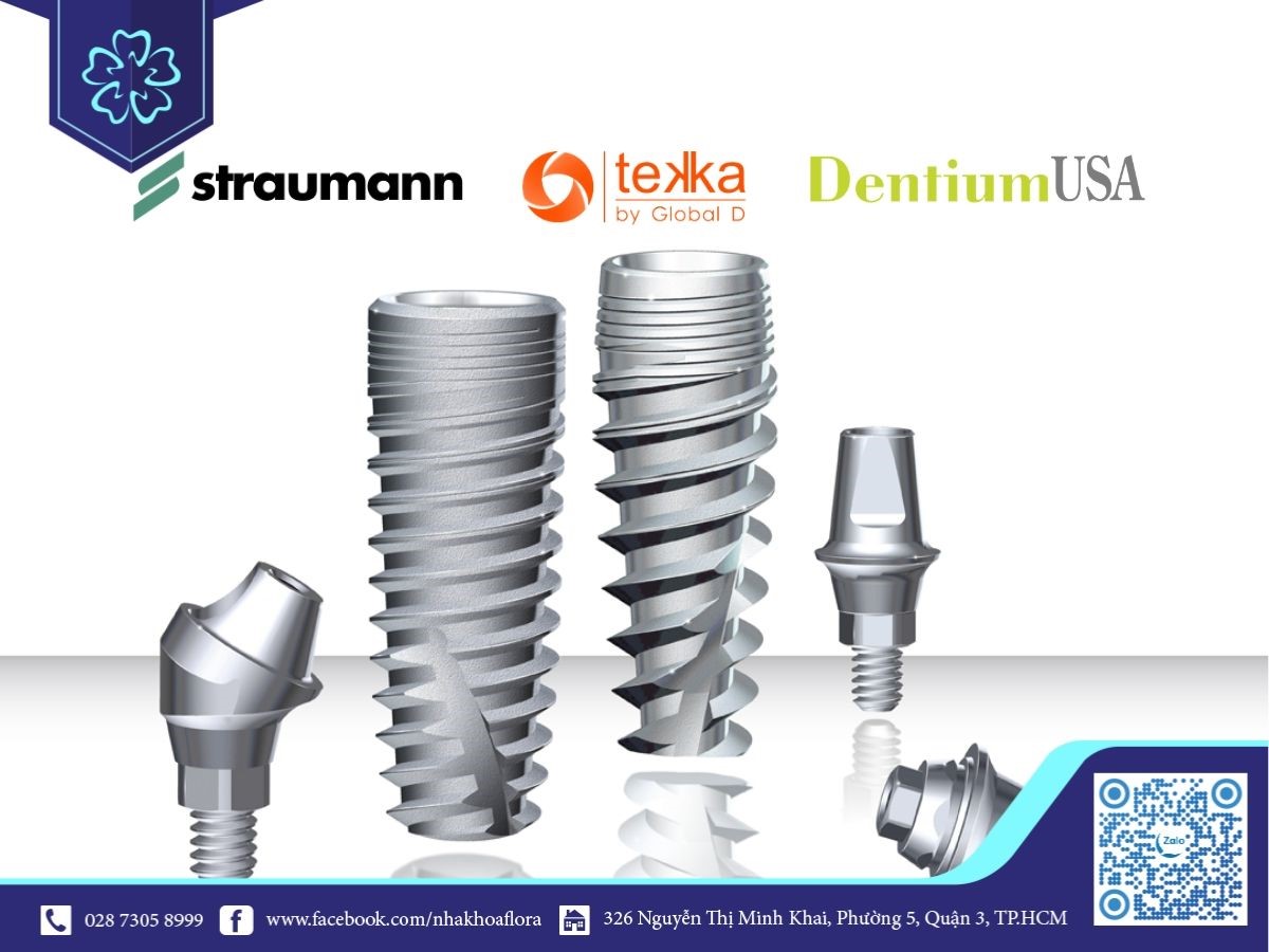 Các loại răng dùng trong cấy ghép Implant phổ biến hiện nay Các loại răng Implant phổ biến hiện nay