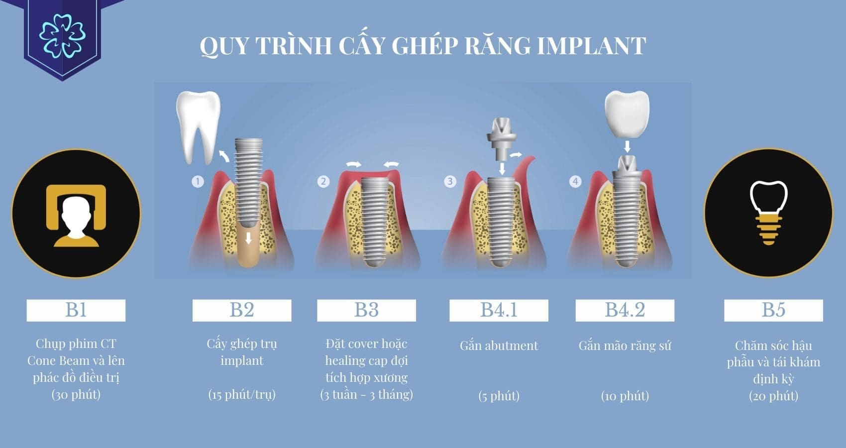 Sophis 3D implant procedure