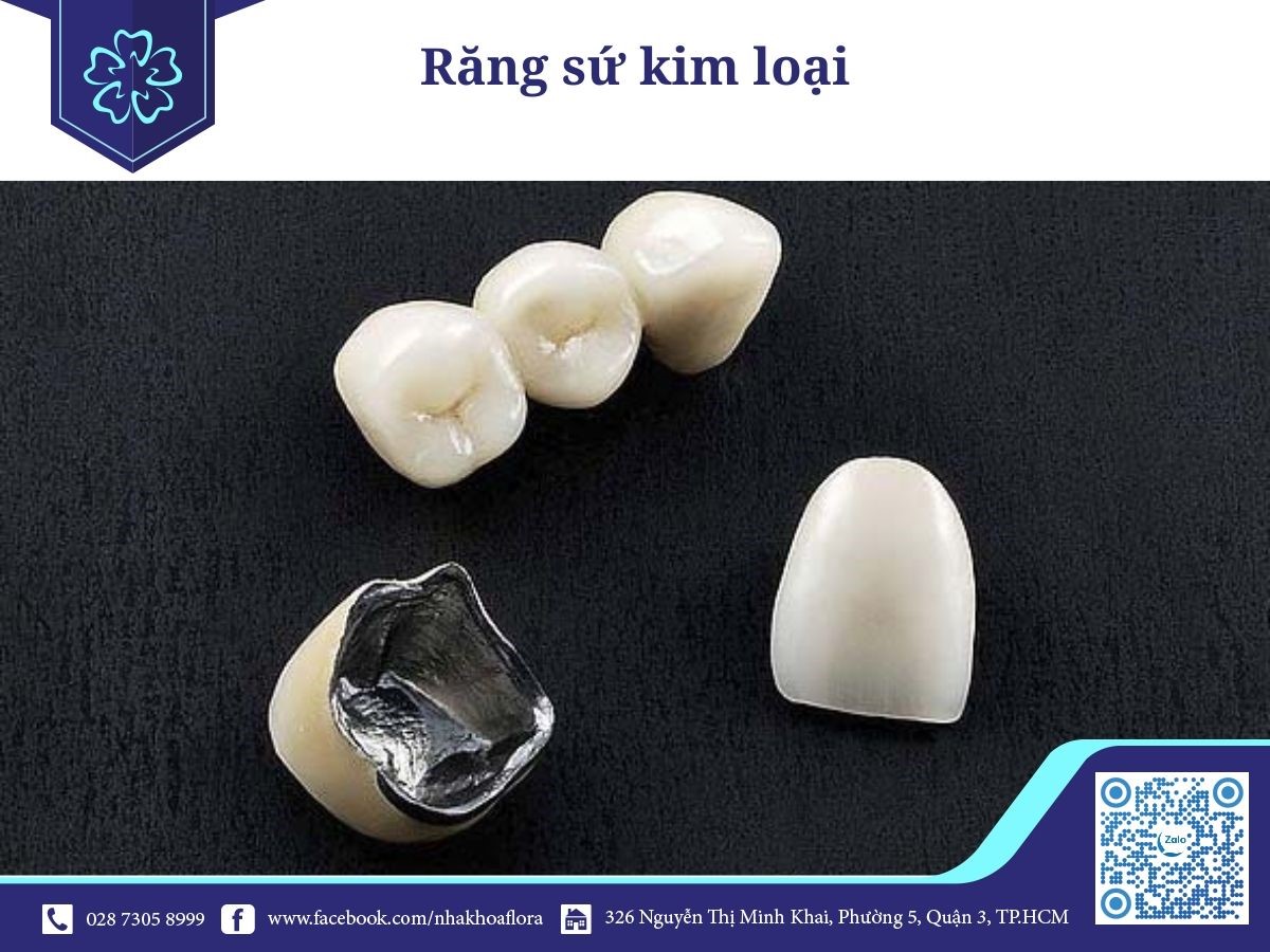 bọc răng sứ kim loại bọc răng sứ kim loại