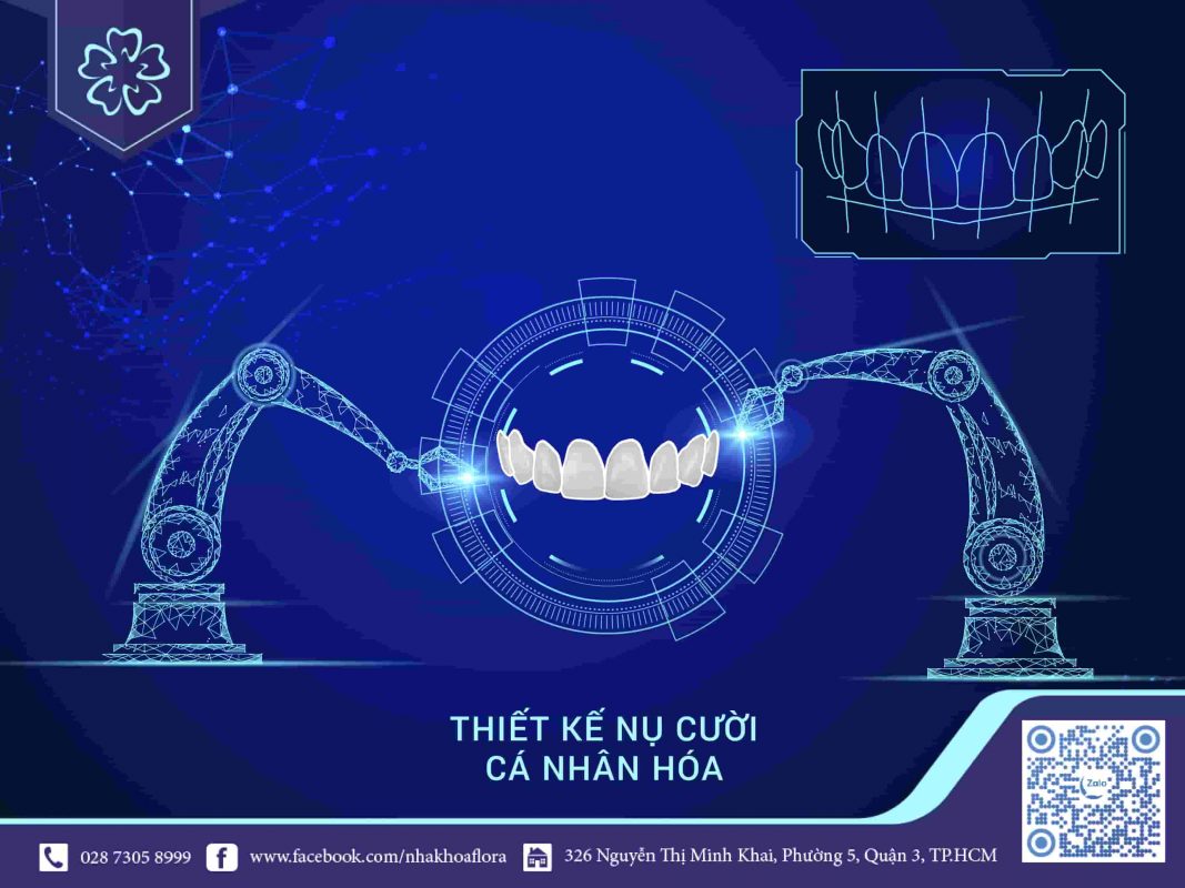 Thiết kế nụ cười trong dán sứ veneer Thiết kế nụ cười trong dán sứ veneer