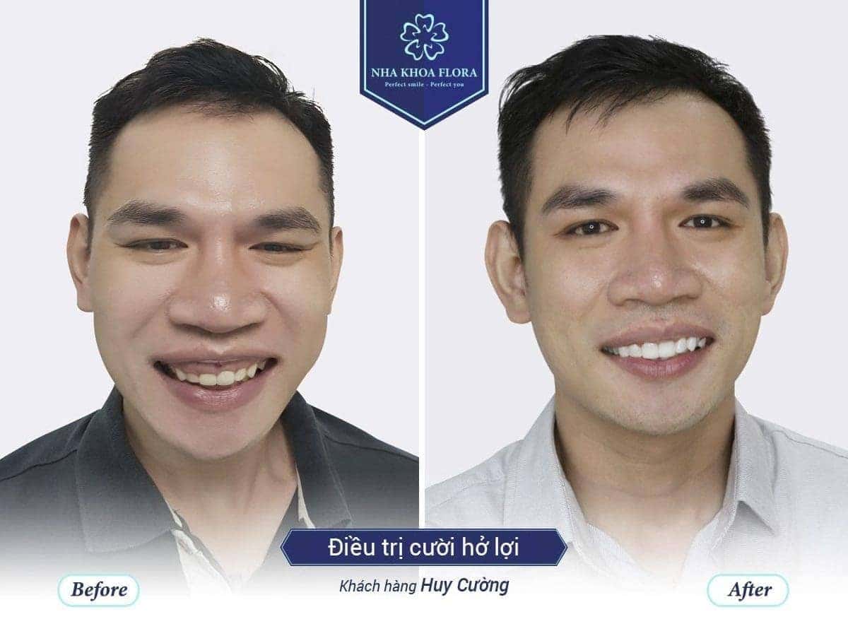 Customers treating smiles - Huy Cuong
