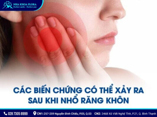 biến chứng sau khi nhổ răng khôn - ảnh 2 biến chứng sau khi nhổ răng khôn - ảnh 2