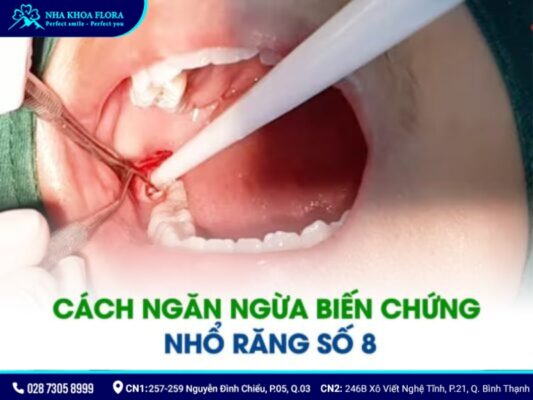 biến chứng sau khi nhổ răng khôn - ảnh 4 biến chứng sau khi nhổ răng khôn - ảnh 4