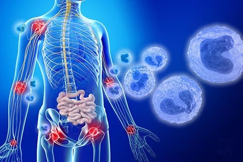 viêm nha chu gây ra các bệnh nguy hiểm khác Viêm nha chu không trị dứt điểm có thể dẫn đến các bệnh lý khác