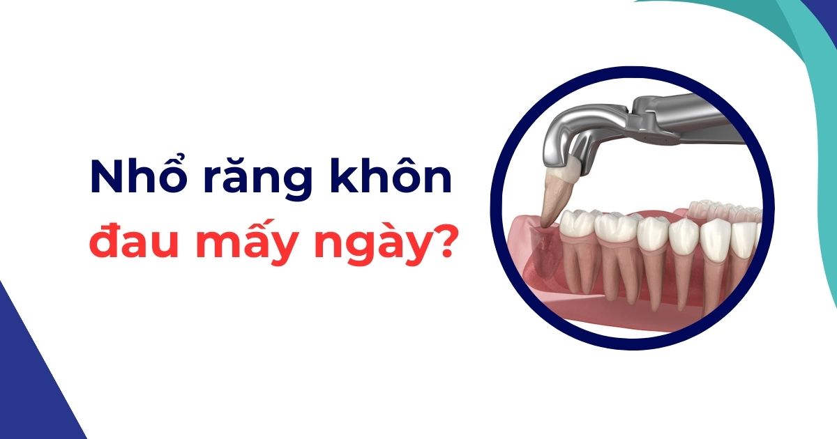Nhổ răng khôn đau mấy ngày? Cách giảm đau nhanh tại nhà