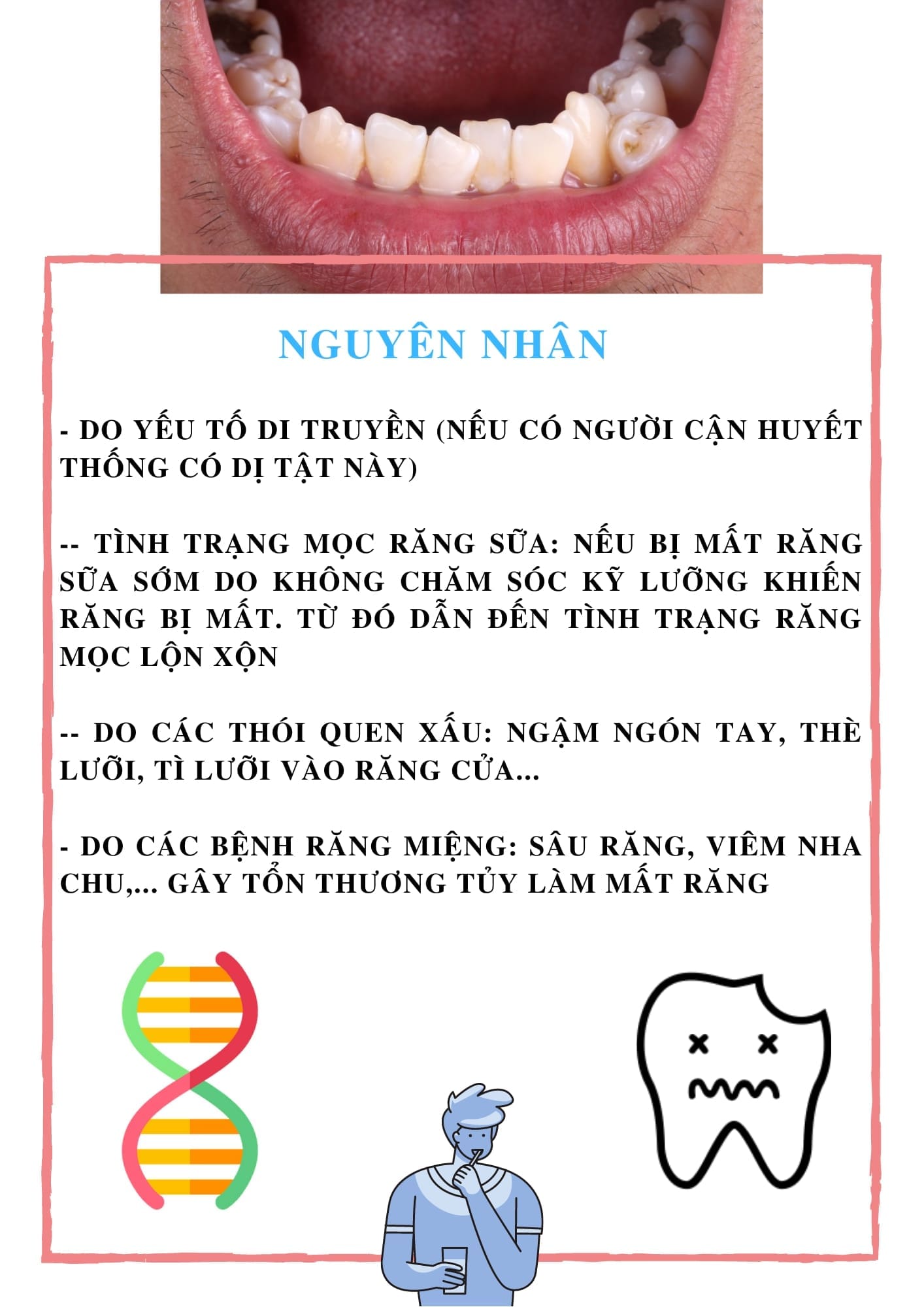 cac-benh-rang mieng các bệnh răng miệng