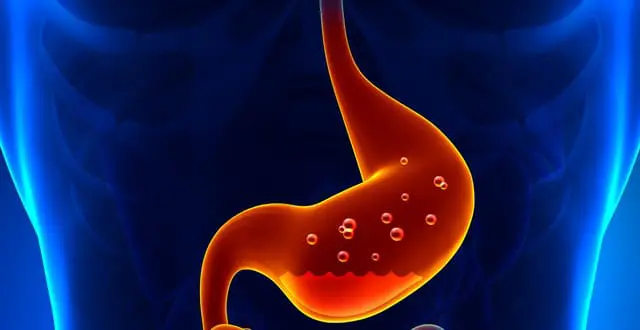 Hôi miệng là bệnh gì? Có chữa trị dứt điểm được không? 4