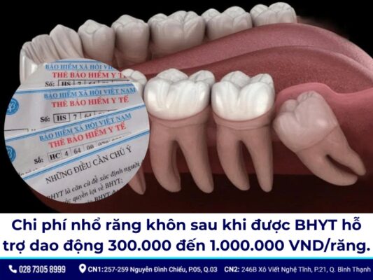 chi phí nhổ răng khôn có bảo hiểm y tế - ảnh 2 chi phí nhổ răng khôn có bảo hiểm y tế - ảnh 2