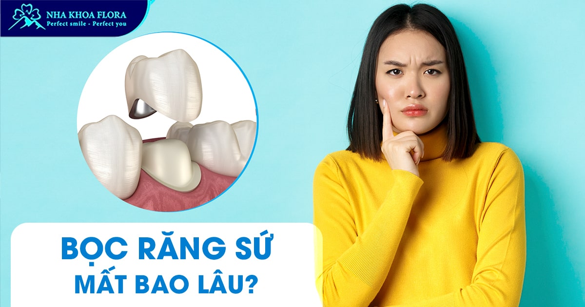Quá trình làm răng sứ mất bao lâu thời gian thì hoàn thành?