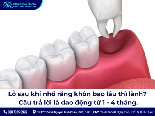 lỗ sau khi nhổ răng khôn - ảnh 3 lỗ sau khi nhổ răng khôn - ảnh 3