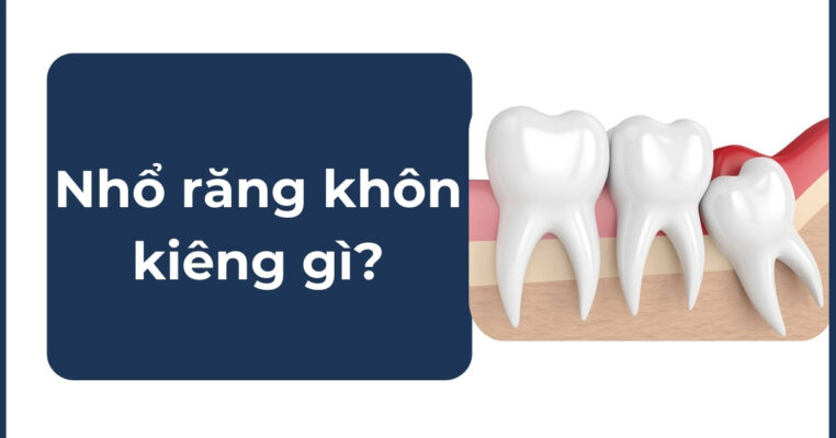 nhổ răng khôn kiêng gì
