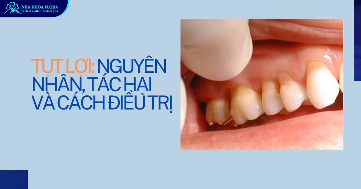 Tụt lợi là gì? Có tự khỏi không? Cách chữa như thế nào?