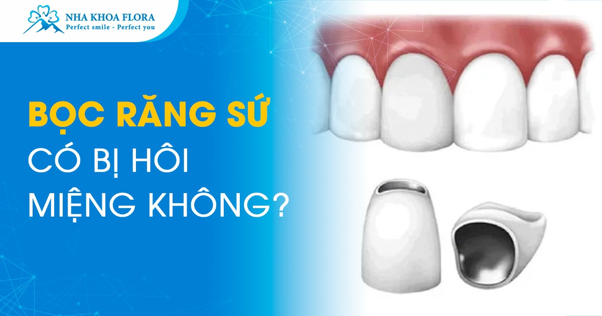 Bọc răng sứ có bị hôi miệng không? Làm sao để khắc phục?