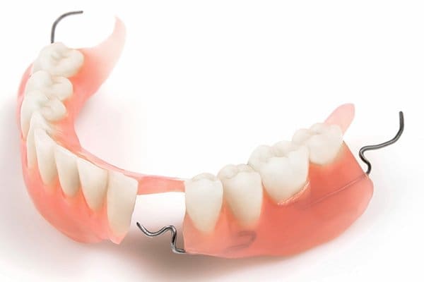 trong-rang-gia-co-lam-hoi-mieng-hay-khong Trồng răng giả có làm hôi miệng hay không?