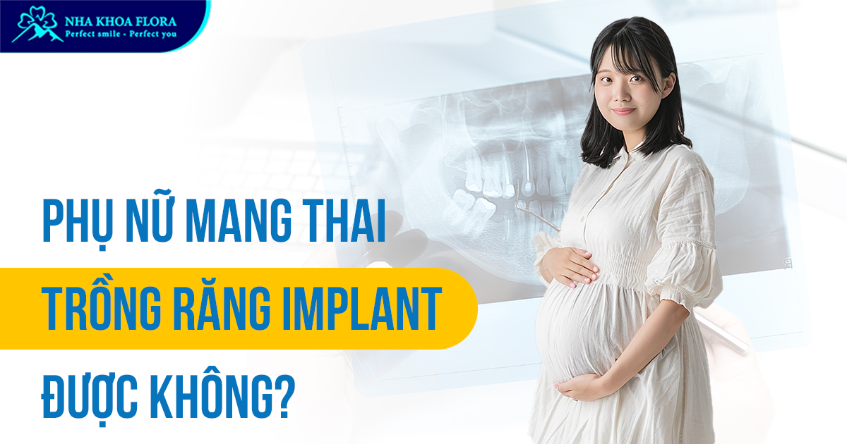 Phụ nữ mang thai trồng răng Implant được không?