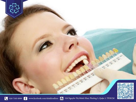 Lựa chọn màu sứ phù hợp với màu răng thật (ảnh minh họa) Lựa chọn màu sứ phù hợp với màu răng thật (ảnh minh họa)