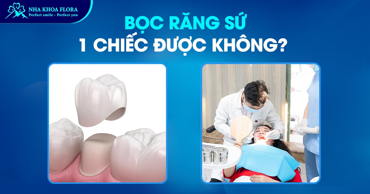 Bọc răng sứ 1 chiếc được không? Chi phí hết bao nhiêu tiền?