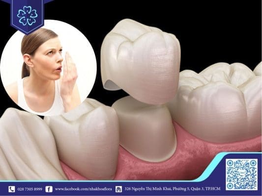 Bọc răng sứ bị hôi miệng là vì đâu? Bọc răng sứ bị hôi miệng là vì đâu?