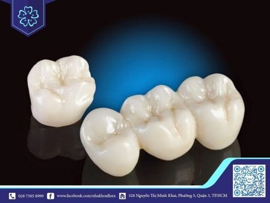 Mão răng sứ trôi nổi, không có nguồn gốc rõ ràng cũng là nguyên nhân gây hôi miệng (ảnh minh họa) Mão răng sứ trôi nổi, không có nguồn gốc rõ ràng cũng là nguyên nhân gây hôi miệng (ảnh minh họa)