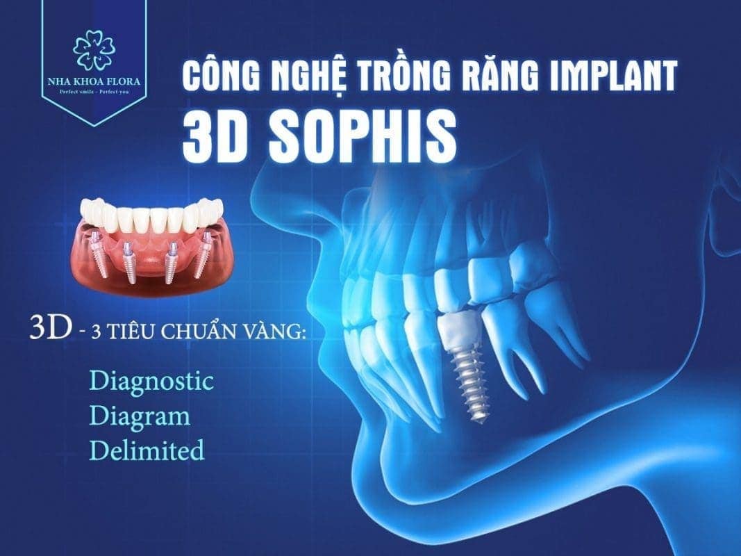 3 tiêu chuẩn vàng trong quy trình trồng răng implant 3D Sophis Công nghệ 3D Sophis tiêu chuẩn Thụy sĩ