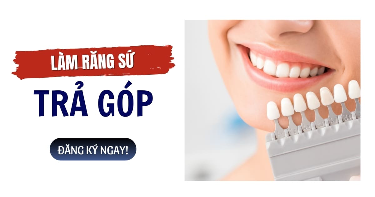 Làm răng sứ trả góp TP.HCM lãi suất 0% tại Nha khoa Flora