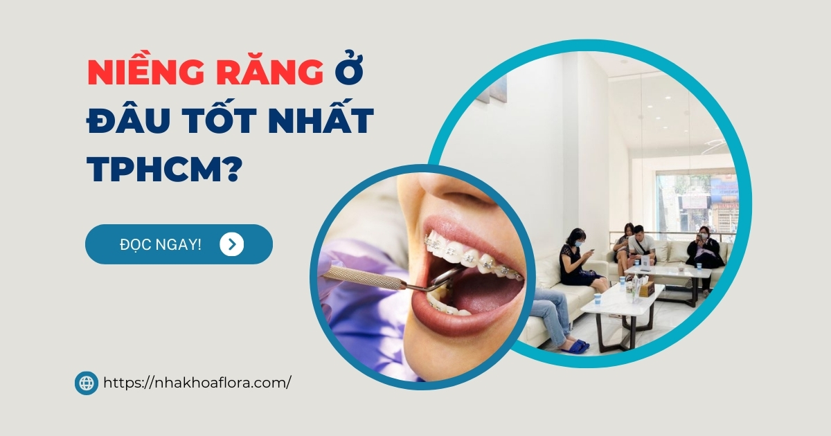 Niềng răng ở đâu tốt nhất TPHCM? Cập nhật mới nhất 2025