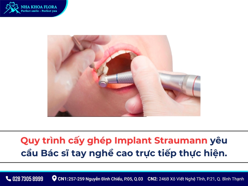 straumann implant