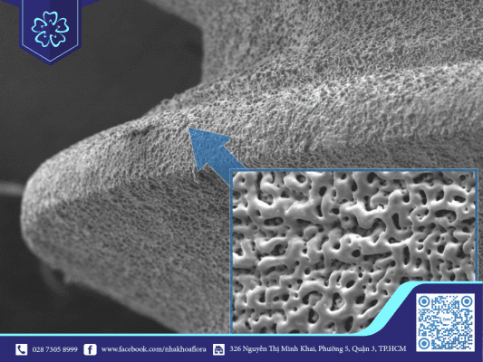 be-mat-tru-implant-duoc-xu-ly-bang-xuong-sinh-hoc Bề mặt trụ implant được xử lý bằng xương sinh học